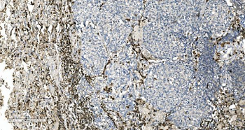 Anti-Coronin 1a/TACO/CORO1A Antibody