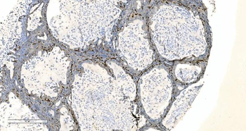Anti-Coronin 1a/TACO/CORO1A Antibody