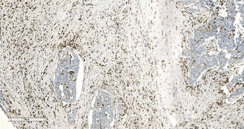 Anti-Coronin 1a/TACO/CORO1A Antibody