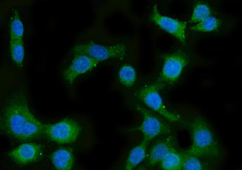 Anti-CYP51A1/CYP51 Antibody