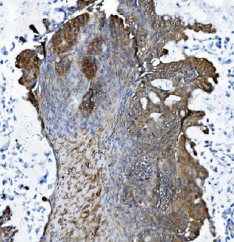 DCTN1/p150-glued Antibody