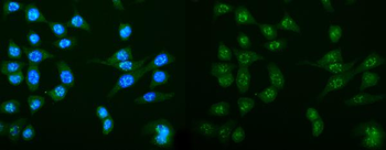 Anti-DCTN1/p150-glued Antibody