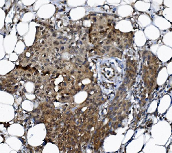 Anti-DCTN1/p150-glued Antibody