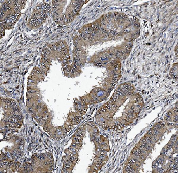Anti-DCTN1/p150-glued Antibody