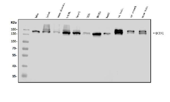 Anti-DCTN1/p150-glued Antibody
