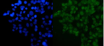 Anti-DYNLL1/PIN Antibody