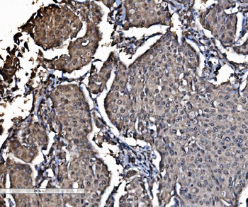 Anti-DYNLL1/PIN Antibody