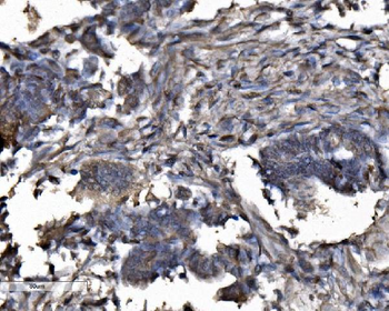 Anti-DYNLL1/PIN Antibody