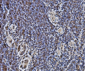 Anti-DYNLL1/PIN Antibody