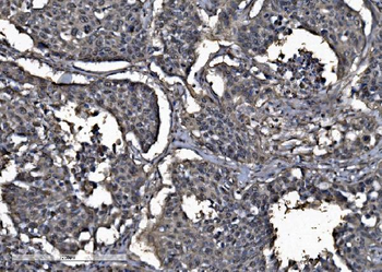 Anti-DYNLL1/PIN Antibody