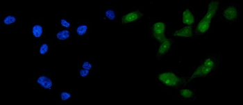 Anti-FOXA2 Antibody