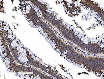 Anti-FOXA2 Antibody