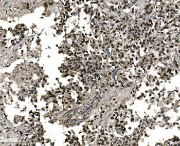 Anti-FOXA2 Antibody