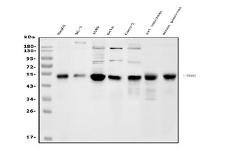 Anti-FOXA2 Antibody
