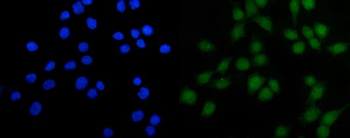 Anti-FOXJ1 Antibody