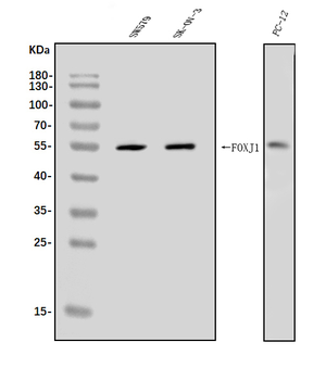Anti-FOXJ1 Antibody