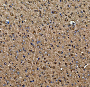 Anti-Aspartate Aminotransferase/GOT1 Antibody