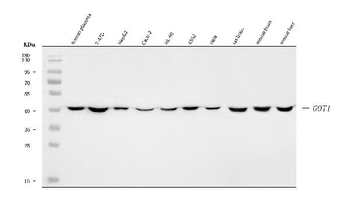 Anti-Aspartate Aminotransferase/GOT1 Antibody