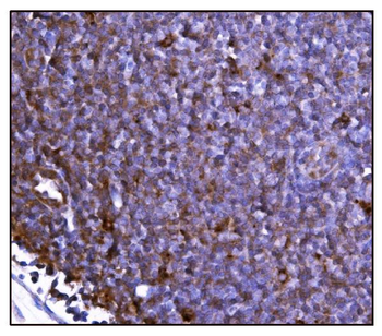 Anti-FABP-1/GOT2 Antibody