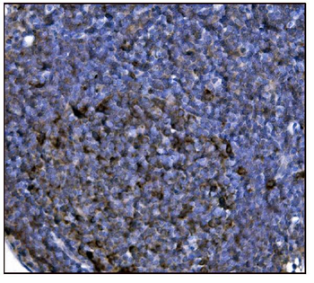 Anti-FABP-1/GOT2 Antibody