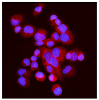 Anti-FABP-1/GOT2 Antibody