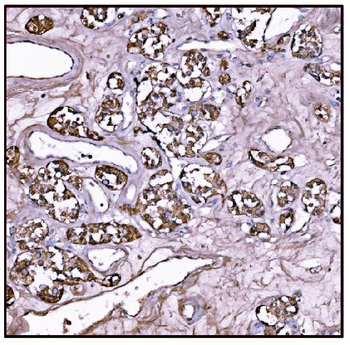 Anti-FABP-1/GOT2 Antibody