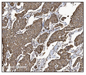 Anti-FABP-1/GOT2 Antibody