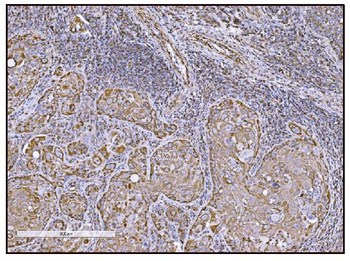 Anti-FABP-1/GOT2 Antibody