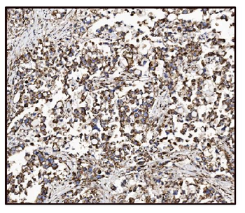 Anti-FABP-1/GOT2 Antibody