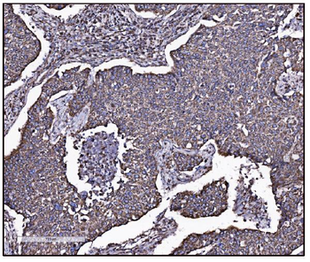 Anti-FABP-1/GOT2 Antibody