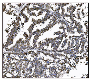 Anti-FABP-1/GOT2 Antibody