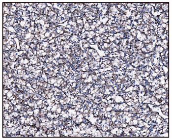 Anti-FABP-1/GOT2 Antibody