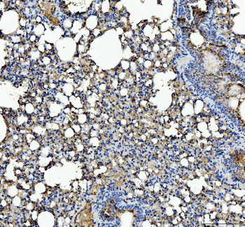Anti-IL1RA/Il1rn Antibody