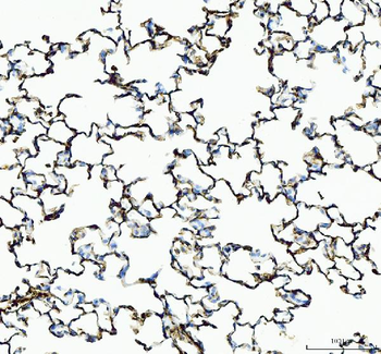 Anti-IL1RA/Il1rn Antibody