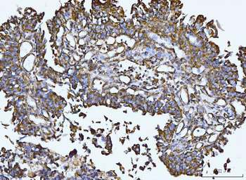 Anti-Integrin linked ILK Antibody