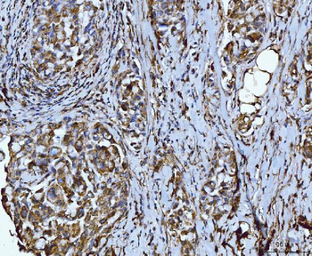 Anti-Integrin linked ILK Antibody