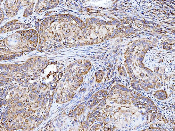 Anti-Integrin linked ILK Antibody