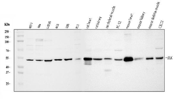 Anti-Integrin linked ILK Antibody