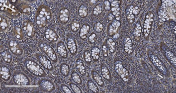 Anti-MIEF1 Antibody