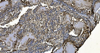 Anti-MIEF1 Antibody