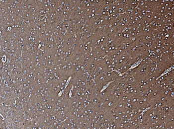 Anti-NSF Antibody
