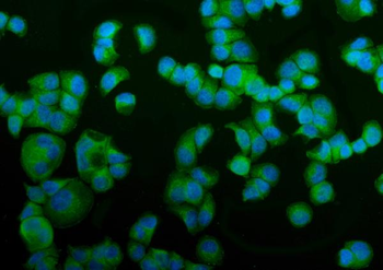 Anti-NSF Antibody