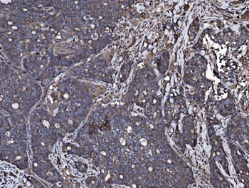 Anti-NSF Antibody
