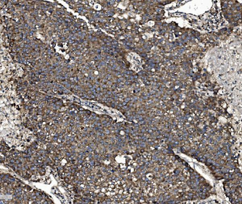 Anti-NSF Antibody