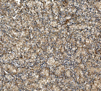 Anti-NSF Antibody