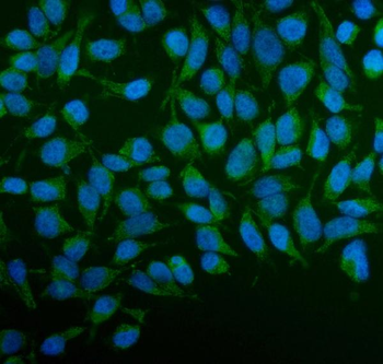 Anti-PFKFB2 Antibody