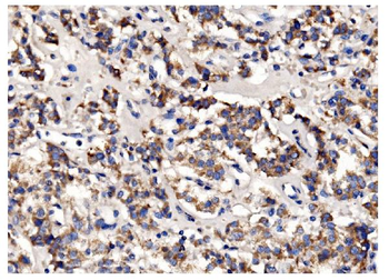 Anti-PFKFB2 Antibody