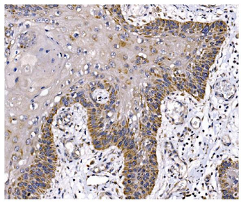 Anti-PFKFB2 Antibody