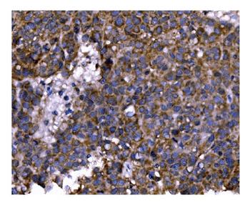 Anti-PFKFB2 Antibody