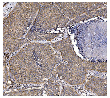 Anti-PFKFB2 Antibody